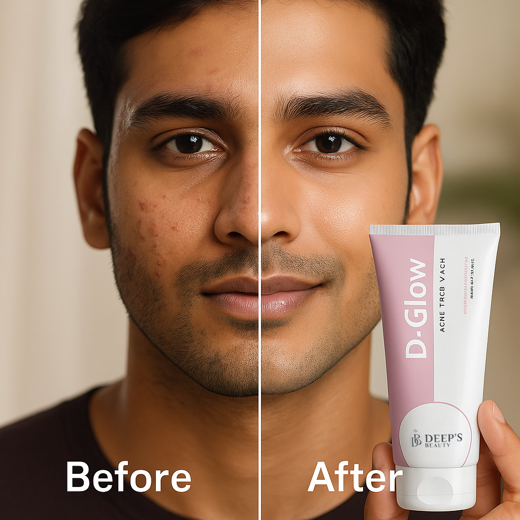 Clear Skin Starts Here | Fights Breakouts, Controls Oil & Fades Acne Scars | Gentle Daily Cleanser for Oily & Acne-Prone Skin | 100ml