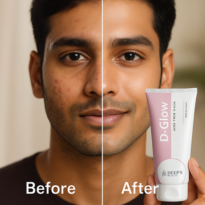 Clear Skin Starts Here | Fights Breakouts, Controls Oil & Fades Acne Scars | Gentle Daily Cleanser for Oily & Acne-Prone Skin | 100ml